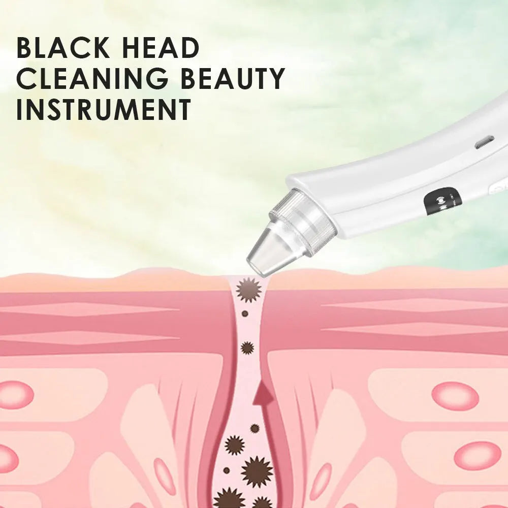 Máquina de belleza para limpieza facial con 3 modos de succión, disponible en stock, con envío rápido. Eliminador de piel muerta, aspirador facial y puntos negros.
